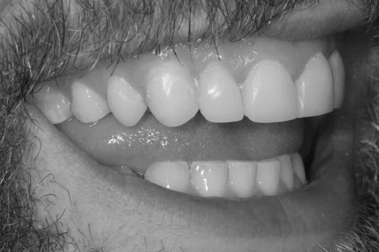 Do you suffer with sensitive teeth? Thumbnail
